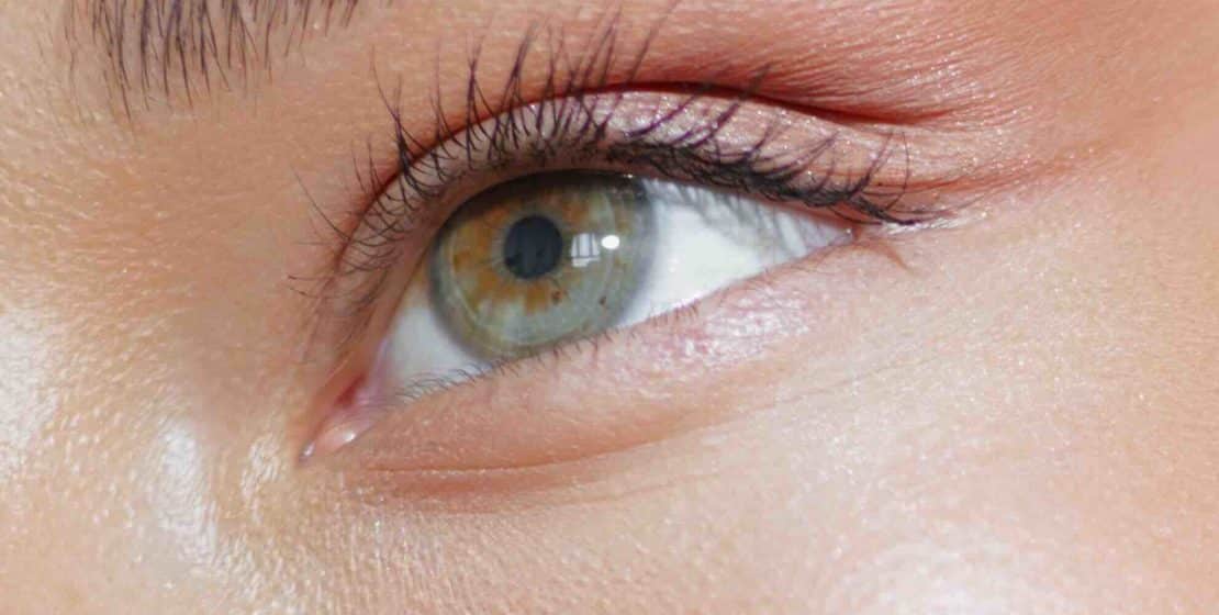 Blépharoplastie